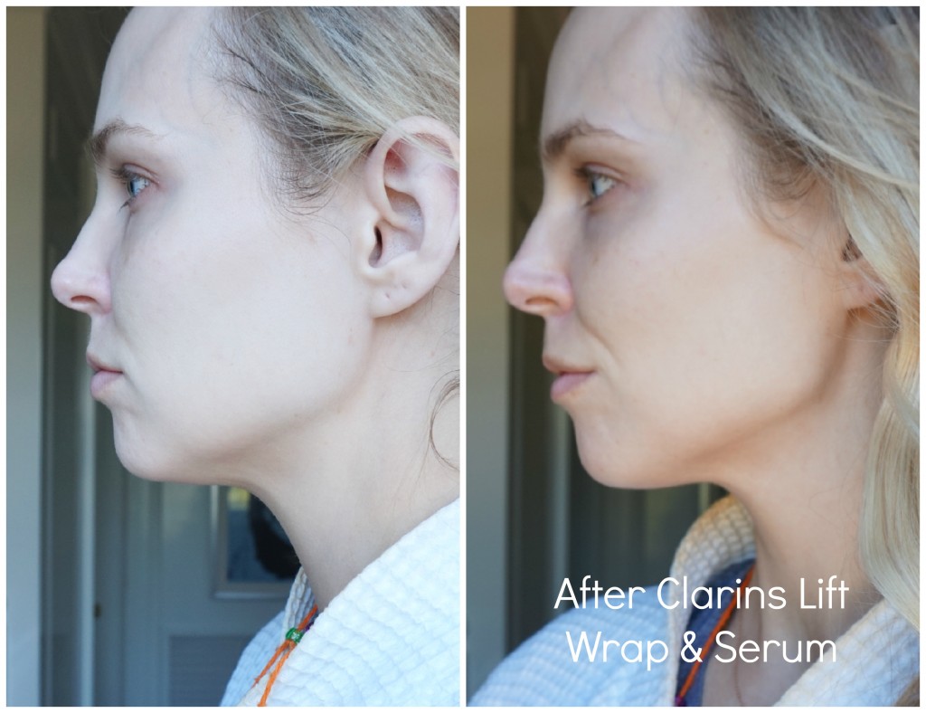 after wrap and serum side 2
