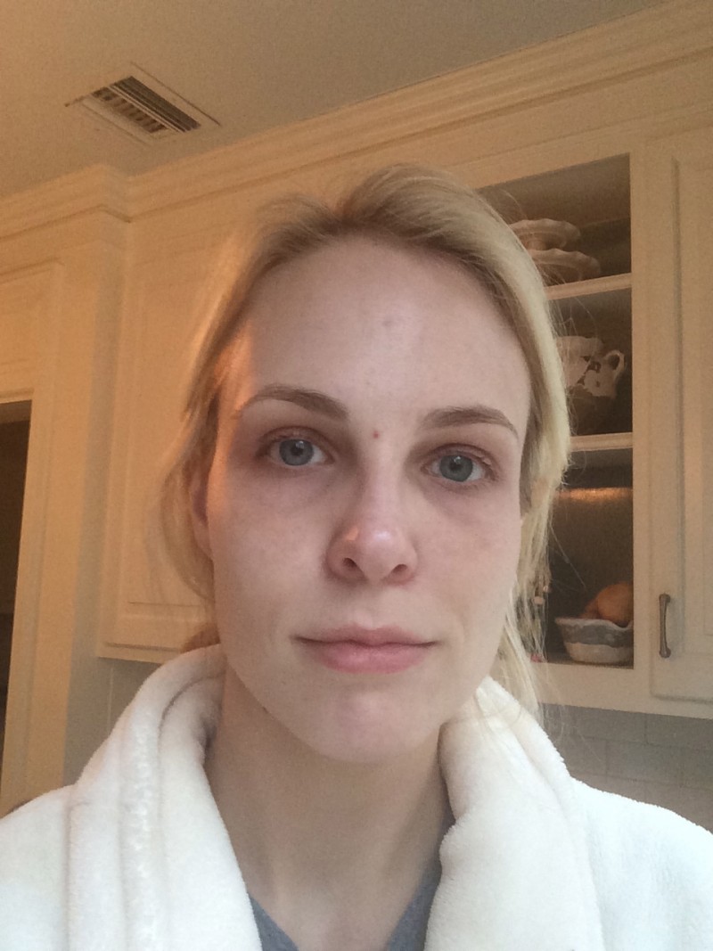 The No-Makeup Fix For Puffy Eyes